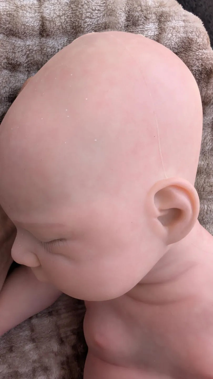 crosta lattea e marmorizzazioni sulla testa proprio come un neonato appena nato